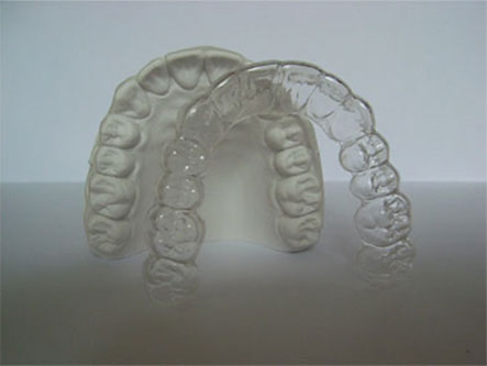 Behandlung Erwachsene unsichtbare Zahnspange